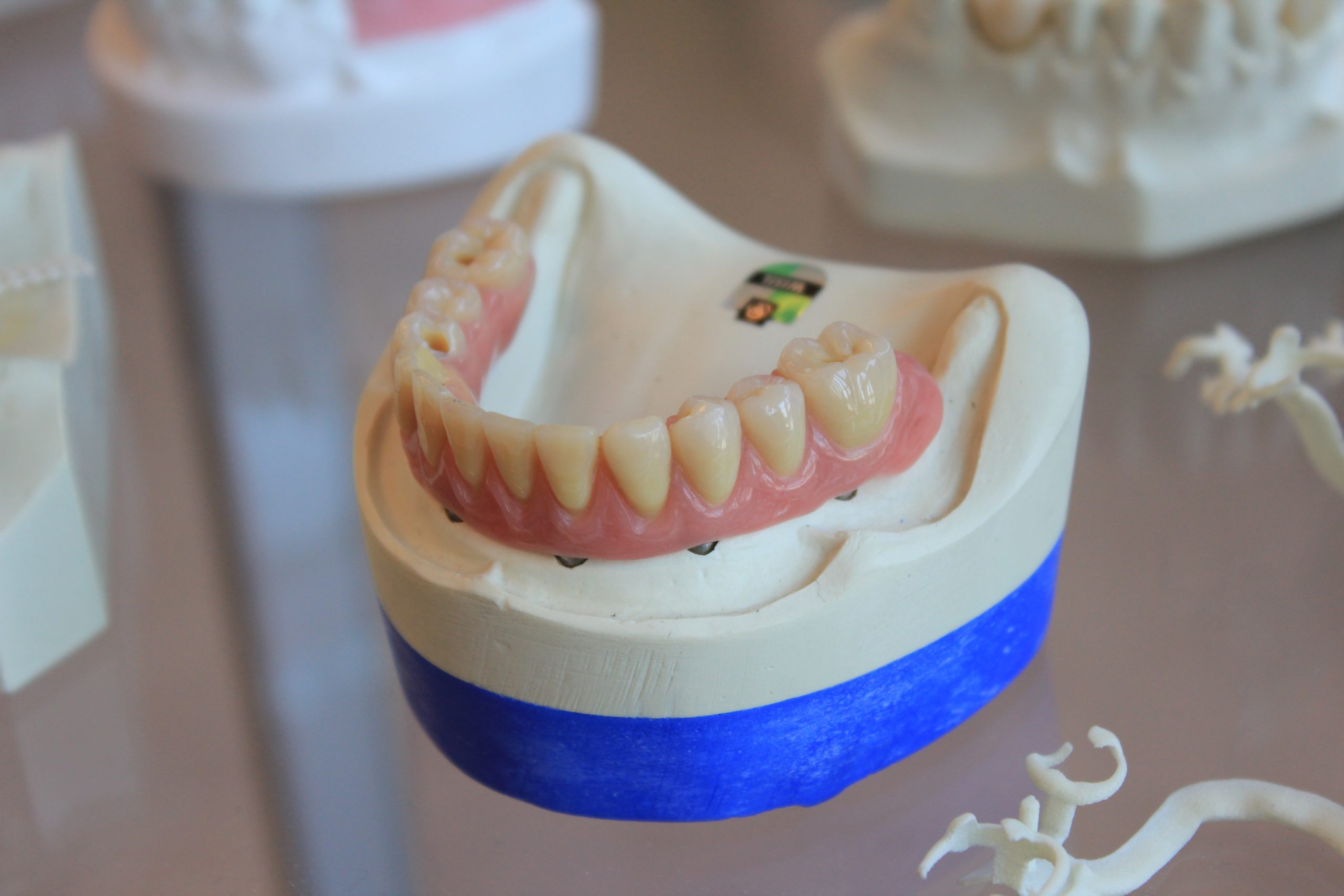 Understanding the Causes of Tooth Decay and Effective Treatment Methods